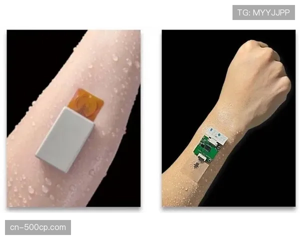 联盟将在夏季联赛测试新型可穿戴传感器，用于追踪球员负荷